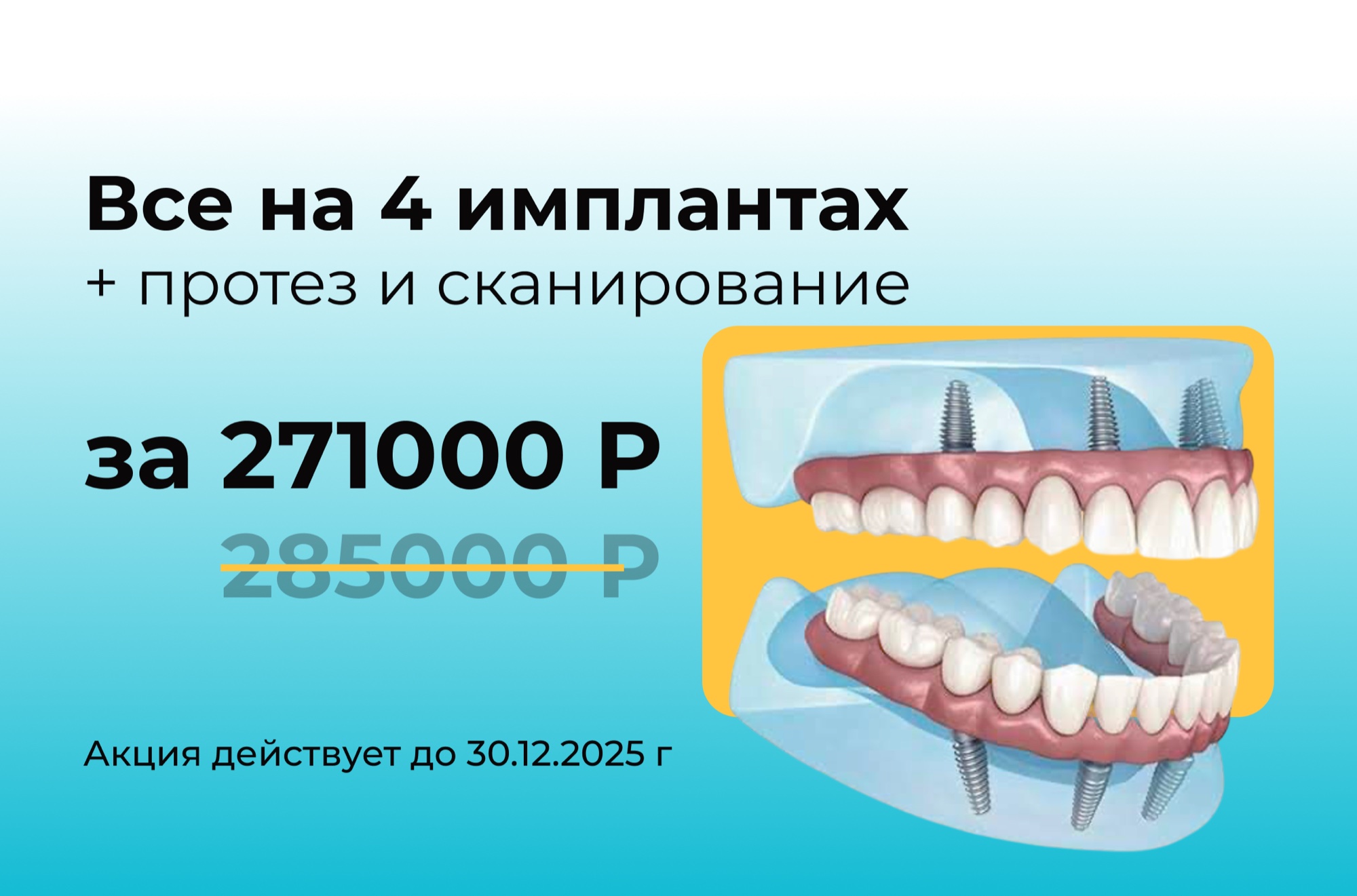 Акция 2