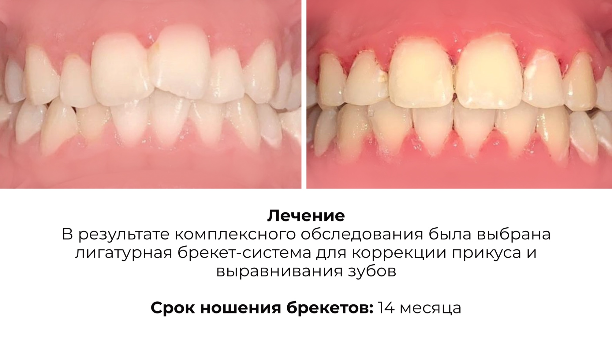 Работа 8