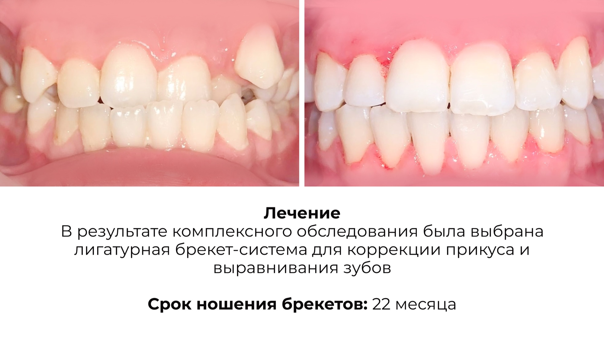 Работа 7
