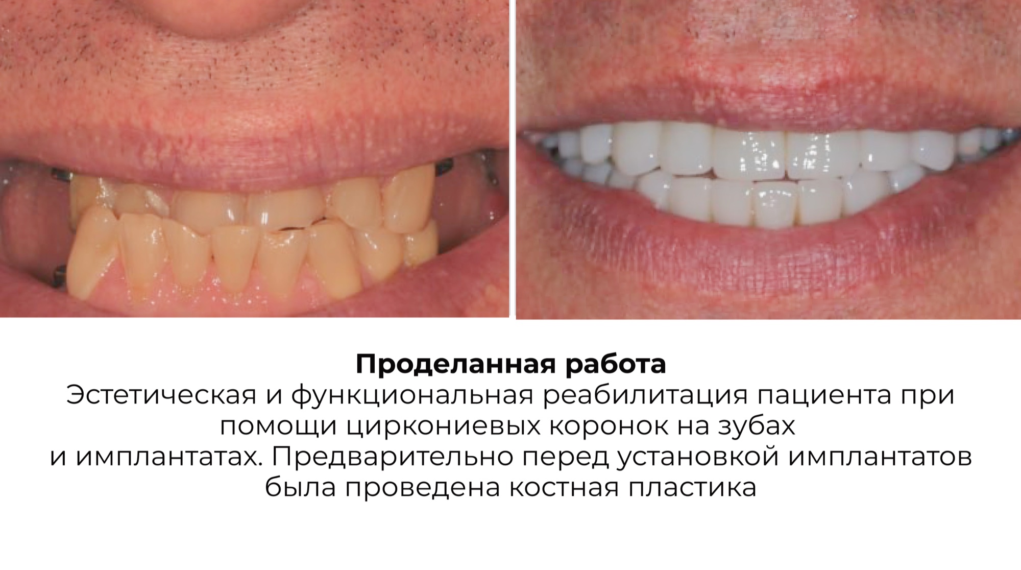 Работа 4