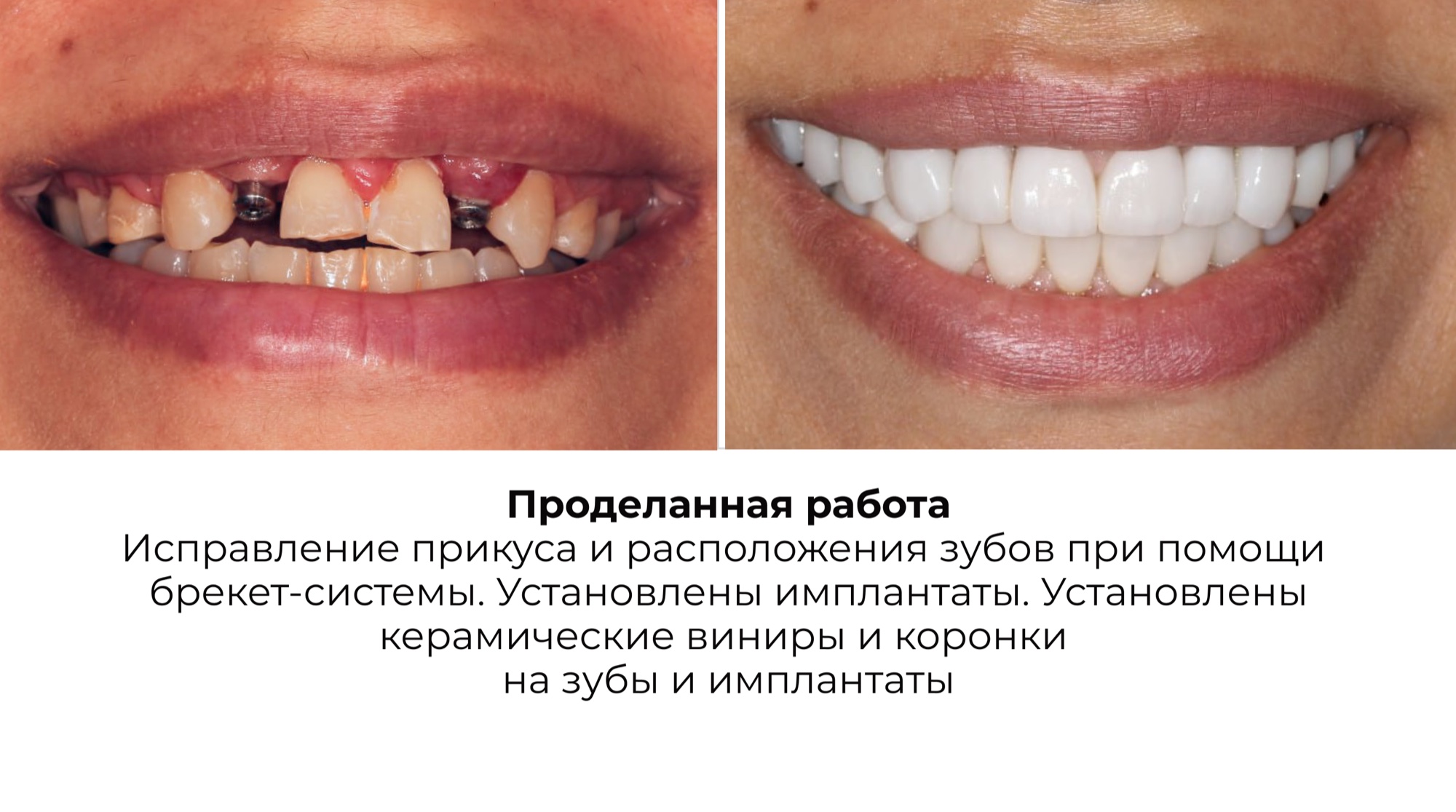 Работа 5