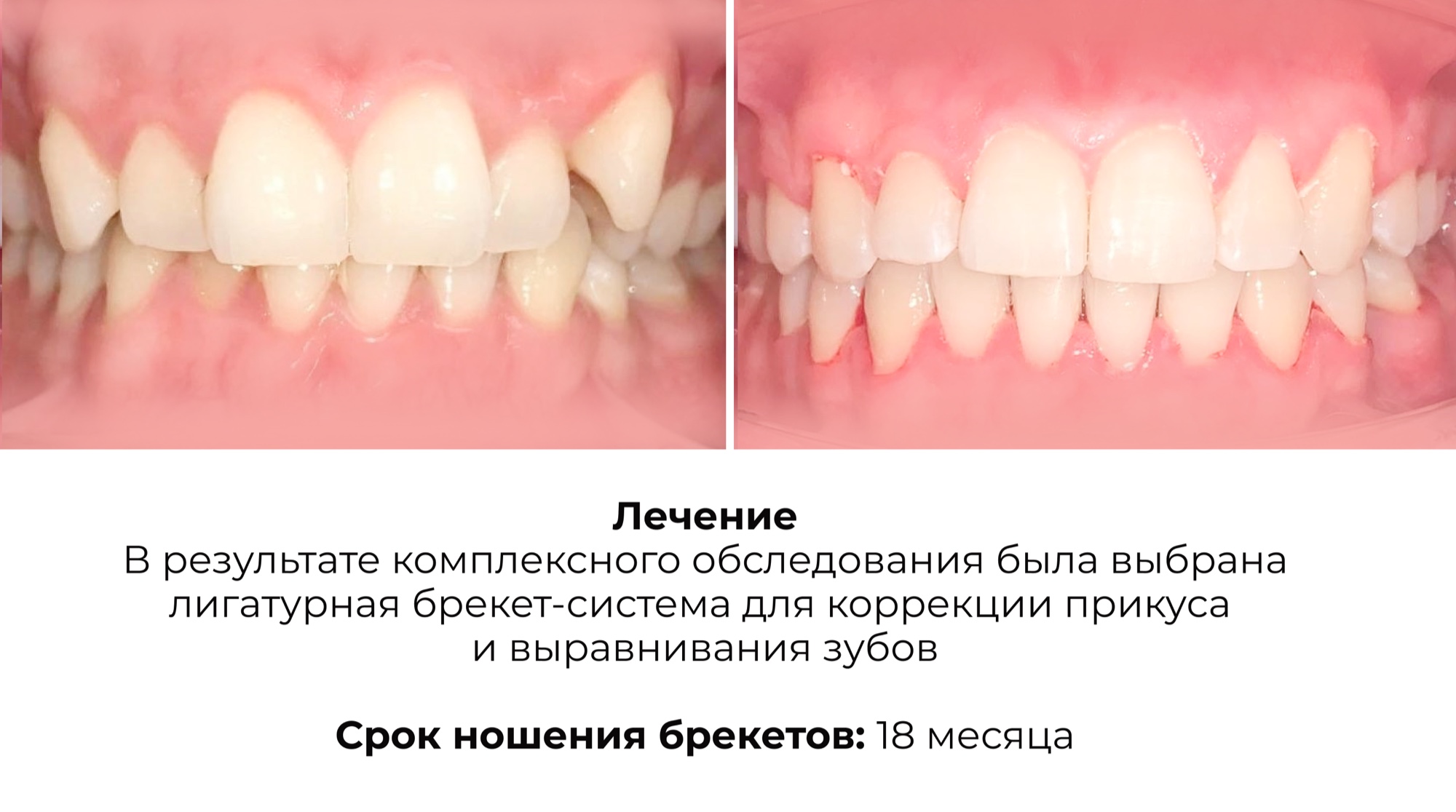 Работа 6